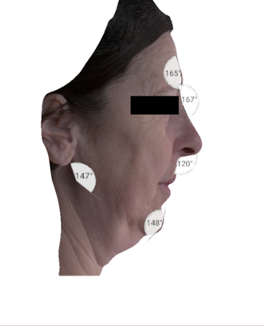 Avant EMFACE — Repères photographiques — droite